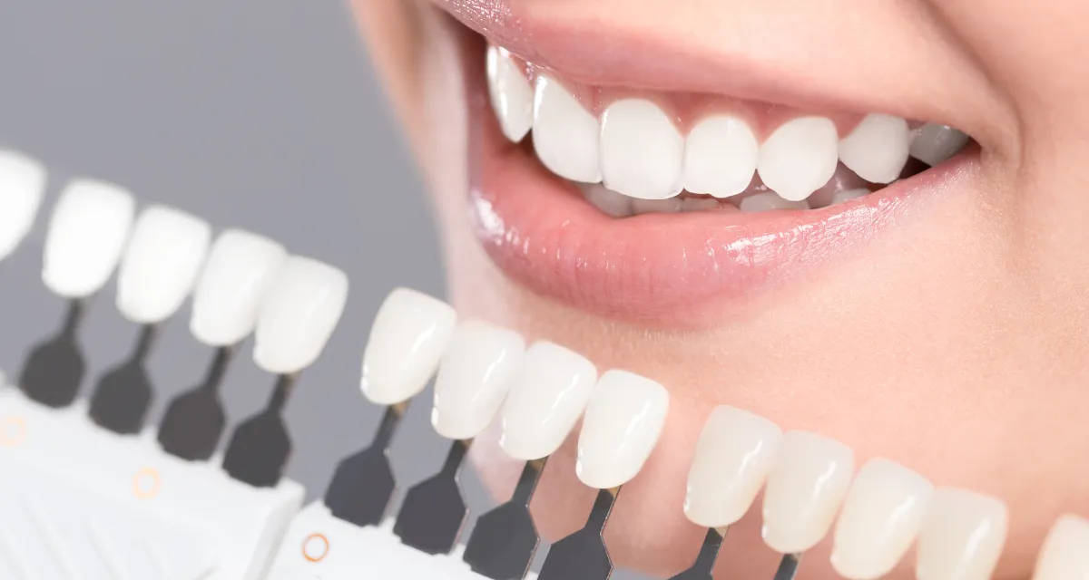 Teeth Whitening